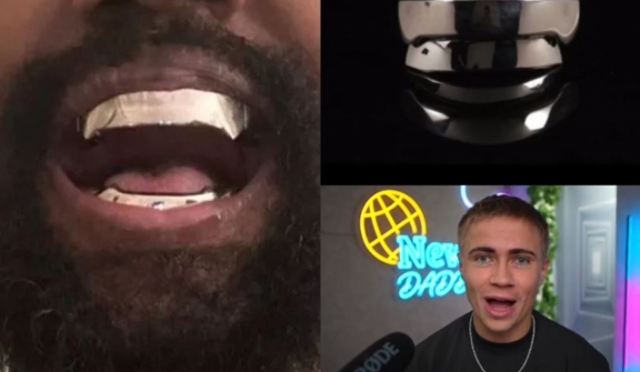 Tiktoker left stunned after explaining how Kanye West cleans his $850,000 titanium teeth