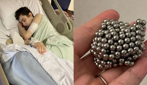 Boy, 12, undergoes six-hour surgery after swallowing 54 magnets to see if he'd become magnetic 