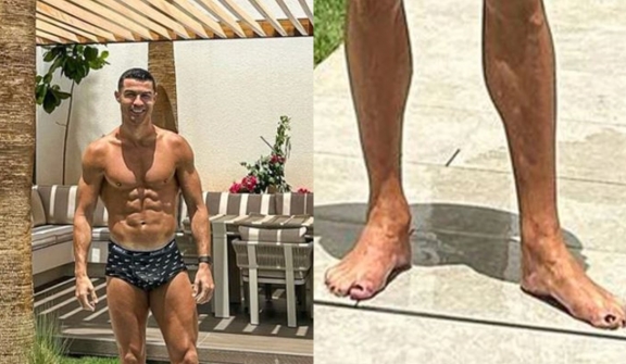 Unraveling the reason why Cristiano Ronaldo is wearing black nail polish on his toes