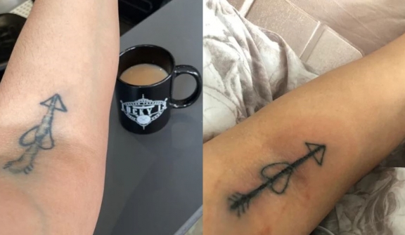 Woman spends $2,000 to fix drunken tattoo mistake