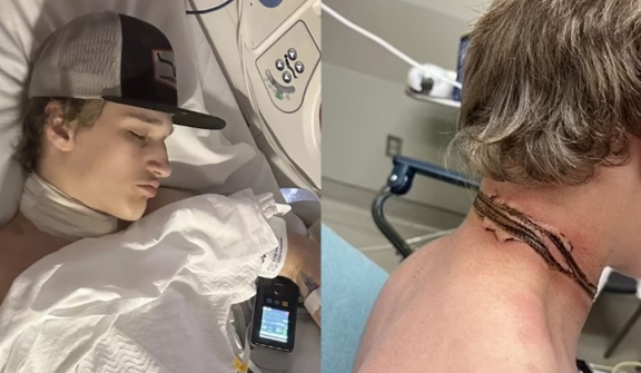 Teen nearly loses life after necklace is electrocuted by phone charger