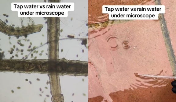 Microscopic reveals weird things in tap water that stuns viewers