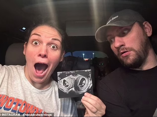 Woman born with two uteruses is now pregnant in both of them, with a child in each at the same time 3