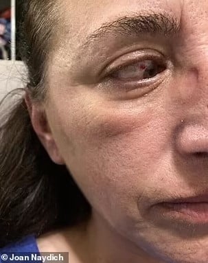 Florida teacher, beaten unconscious by 270 pound student, forced to live off donations after being put on unpaid leave by school 3