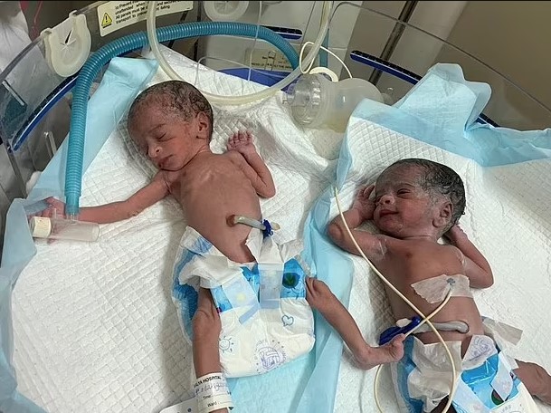 70-year-old births twins after IVF treatment, becoming one of world’s oldest childbearing woman 4
