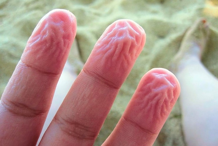 Why do fingers become wrinkly in water? 2