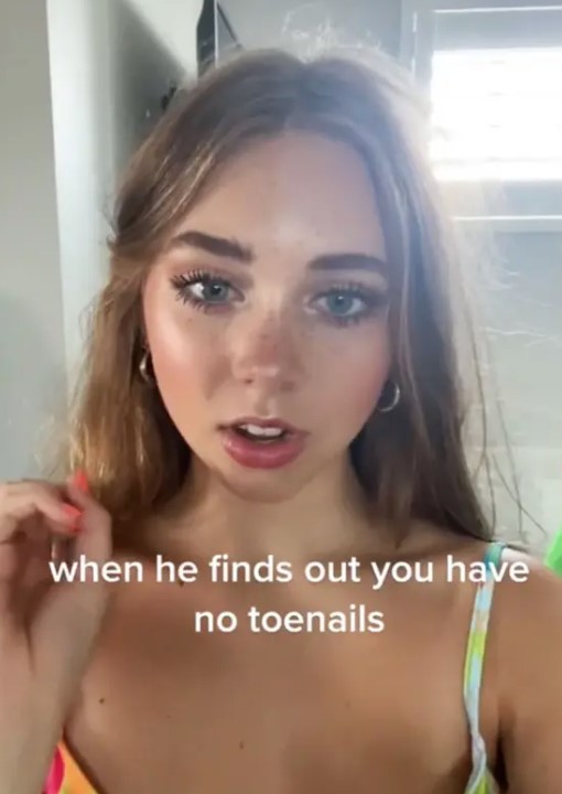 The 18-year-old used to be isolated because of her different toenails.  Image Credit: TikTok/@annabelleeanderson