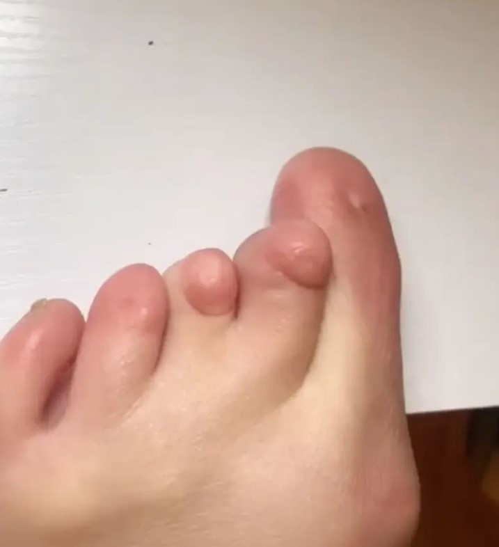American woman was born without toenails, revealing the challenges she had to face 2