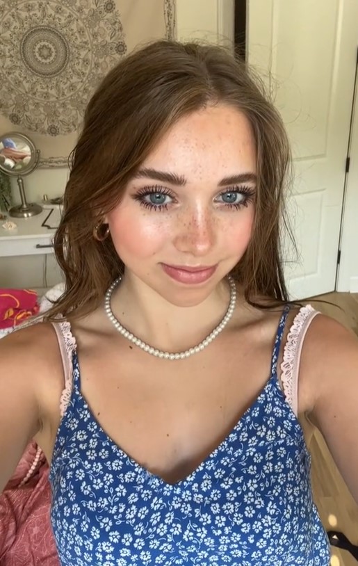 Annabelle got rid of low self-esteem thanks to support from the online community and a friend with the same condition as her. Image Credit: TikTok/@annabelleeanderson