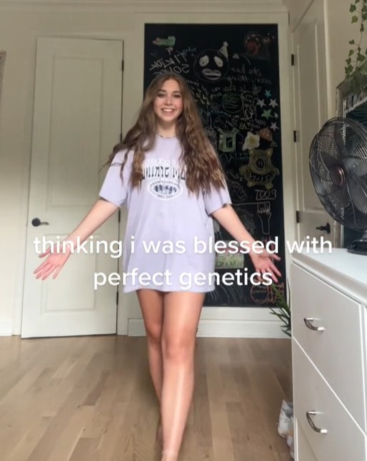 The girl no longer feels embarrassed about her special situation. Image Credit: TikTok/@annabelleeanderson