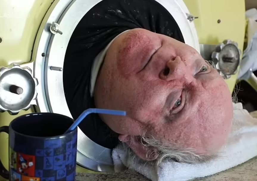 Man relied on iron lungs to breathe for 70 years after contracting polio 4