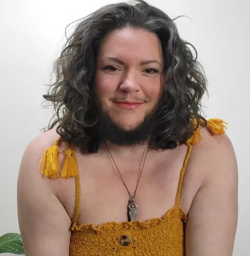 Woman who was bullied due to her naturally bushy beard decided to grow out her whiskers 3