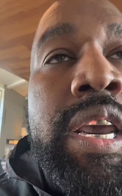 Mysterious lump on Kanye West's upper lip makes fans curious about its origin 2