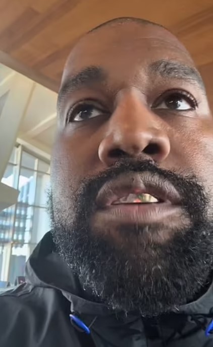 Mysterious lump on Kanye West's upper lip makes fans curious about its origin 4