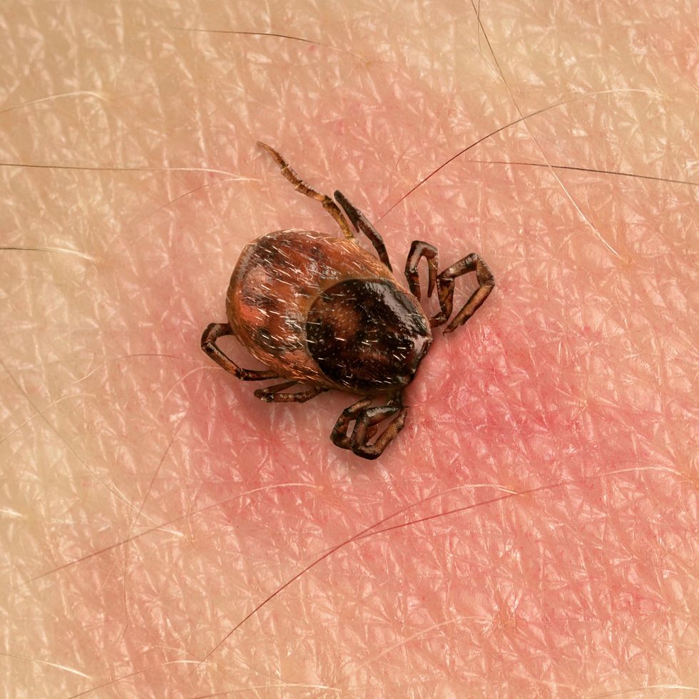 Ticks can leave blood spots and cause unexplained bites, sometimes with a bullseye pattern, indicating their presence. Image credit: Getty