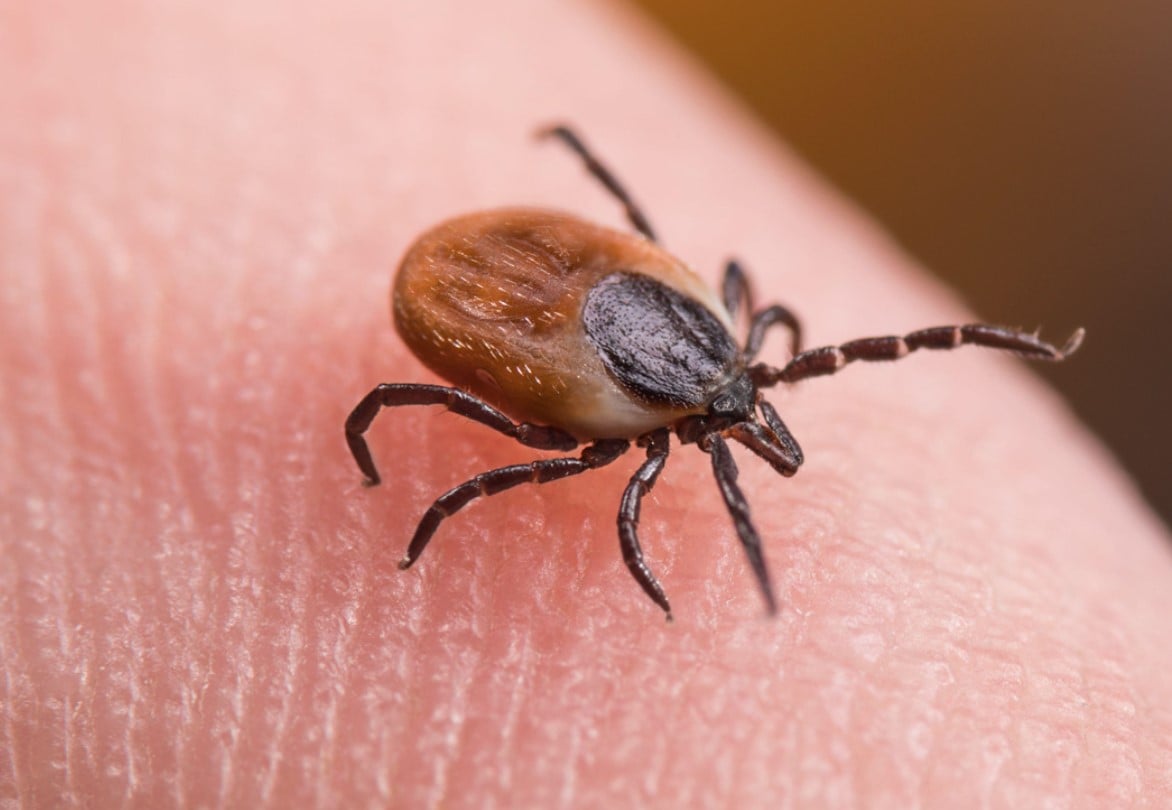 To remove a tick from your body, use fine-tipped tweezers to grip it and pull gently upward. Clean the area afterward. Image Credit: Getty
