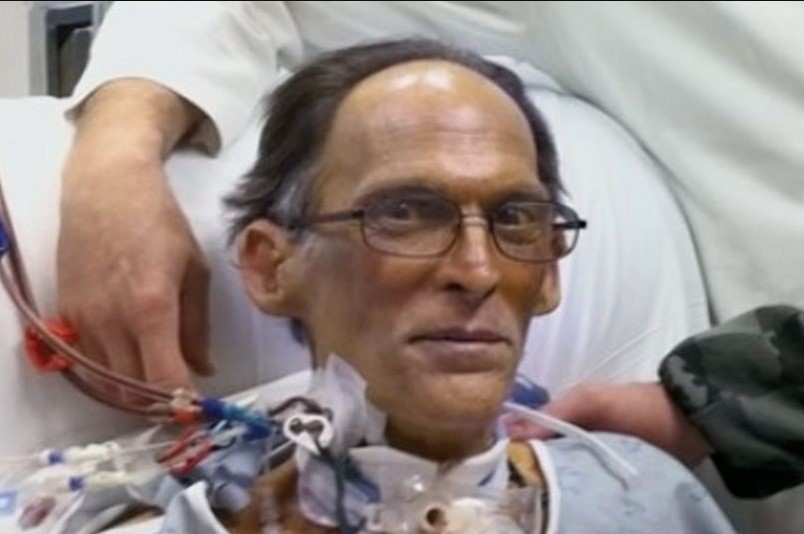 World's first man lives for a month without a heart or a pulse 1