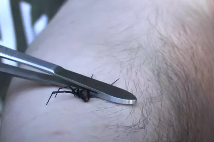 Man intentionally gets bitten by black widow spiders to experience real pain caused by the insect 5