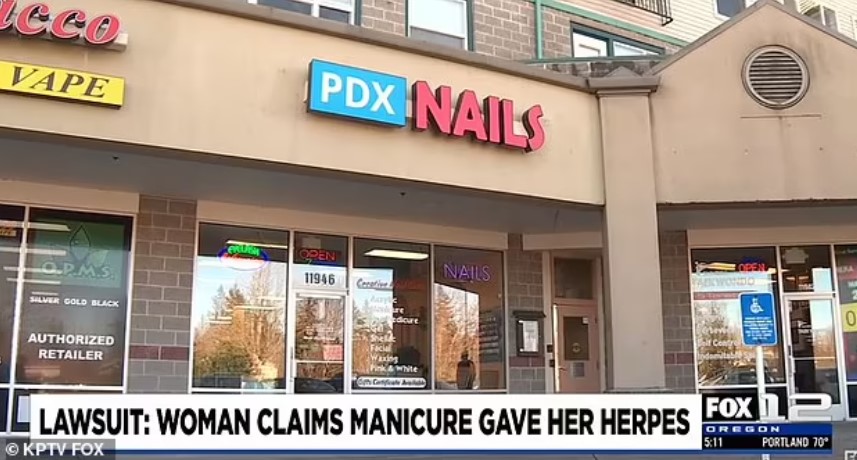Young girl sues nail salon for $1.75M as she got herpes after getting her nails done there 3