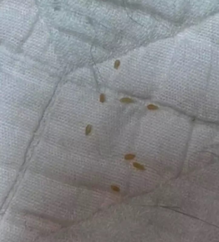 Woman baffled after discovering what ‘sesame seed size things’ appeared on her bed actually are 2