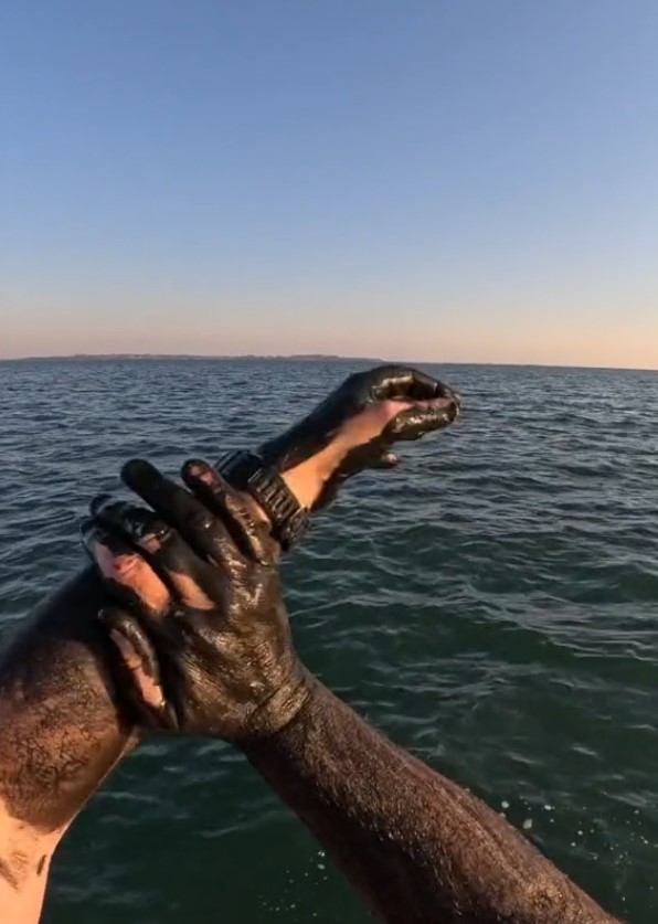Man suffered awful outcome after five days as he rubbed squid ink on himself 5