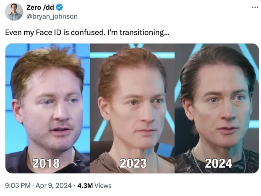 Biohacker reverse aging by son's blood declares he's transitioning 4
