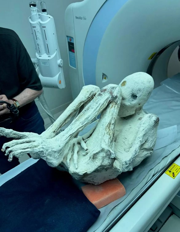 Authorities attempt to seize 'alien mummy' found in Peru due to its mysterious origin 3