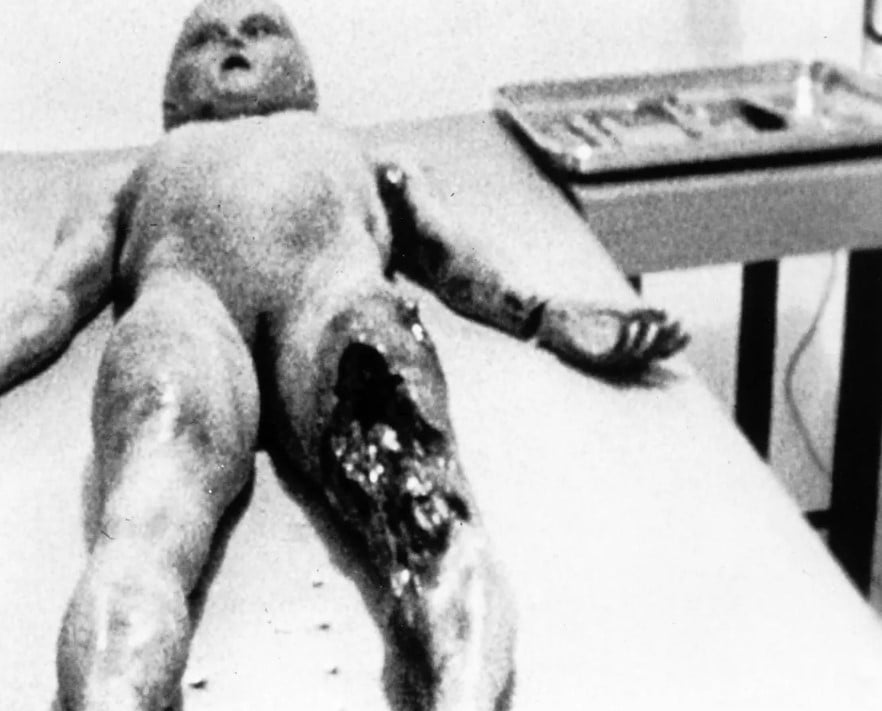 The supposed original alien autopsy film claimed to show the dissection of an alien recovered in Roswell, New Mexico in 1947. Image Credit: Chanel 4