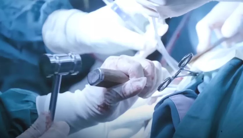 The doctor highlighted the risks, mentioning possible paralysis or death from the surgeries. Image Credit:  Shenzhen University General Hospital
