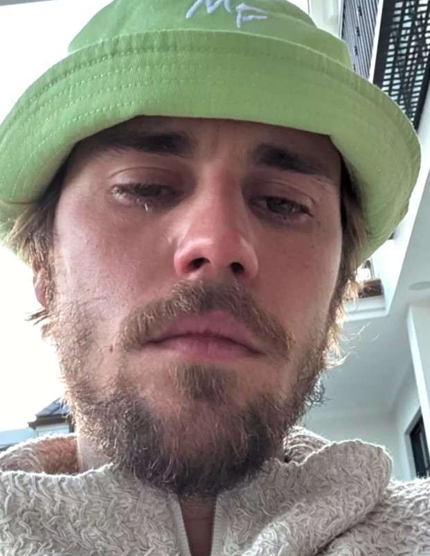 Justin's crying photos left fans concerned. Image Credit: Instagram