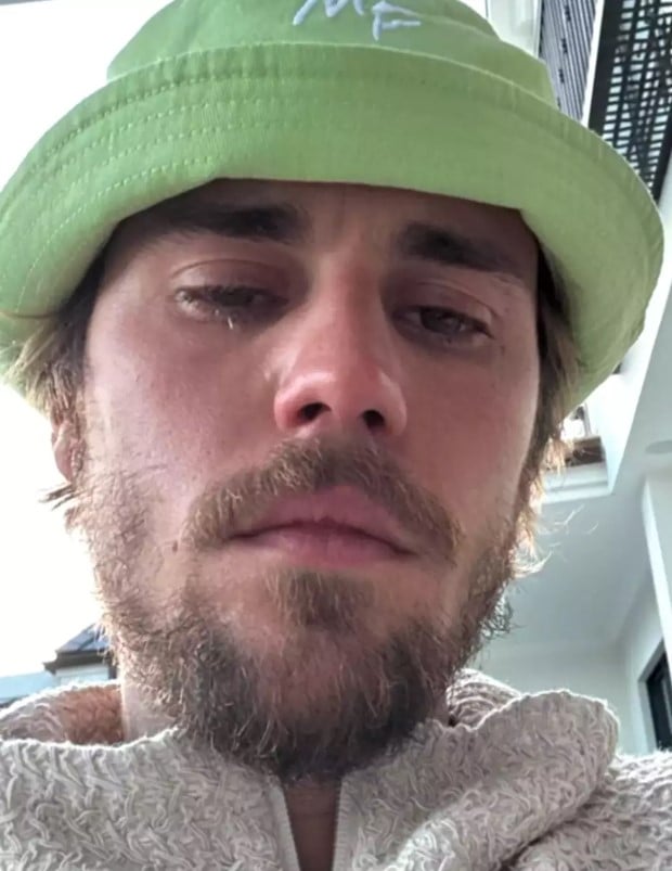 Justin Bieber's crying pictures on social media worried his fans. Image Credit: Instagram