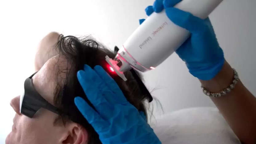 Biohacker who spends $2M annually to reverse age claims victory over balding and graying hair 3