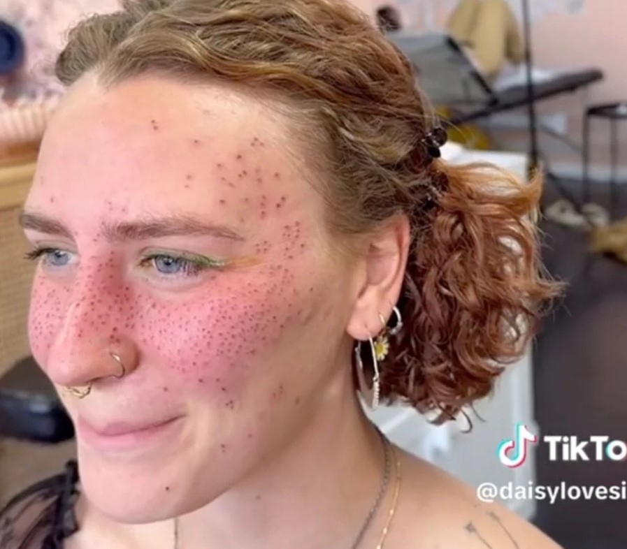Influencer criticized for painting henna 'freckles' on face to mock people with skin pigment issues 5