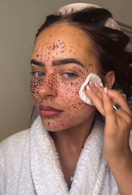 Influencer criticized for painting henna 'freckles' on face to mock people with skin pigment issues 3