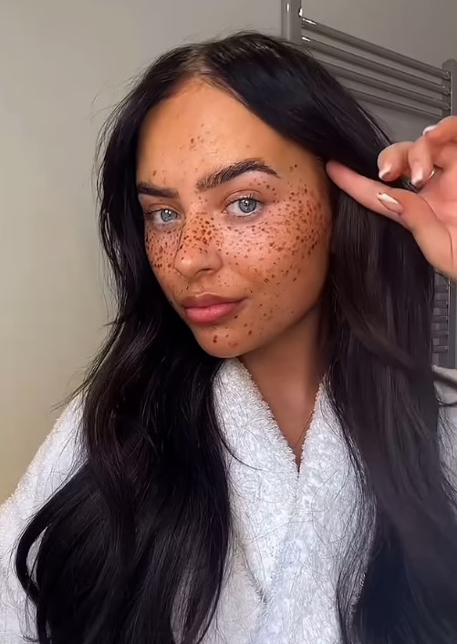 Influencer criticized for painting henna 'freckles' on face to mock people with skin pigment issues 4