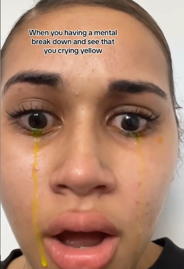 Woman left people stunned after crying with bizarre yellow 3
