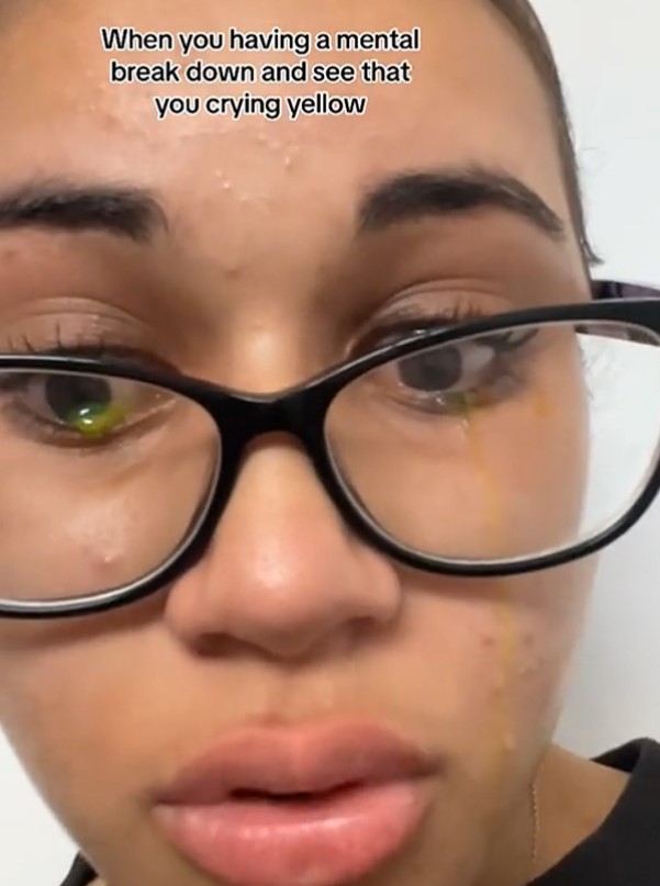 Woman left people stunned after crying with bizarre yellow 4