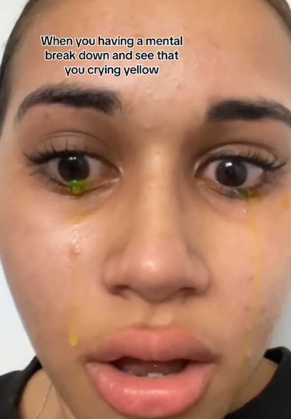Woman left people stunned after crying with bizarre yellow 2