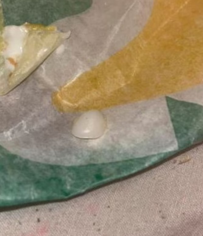 Murray shared a photo of the tooth, causing deep disturbance and feelings of illness. Image Credit: Reddit