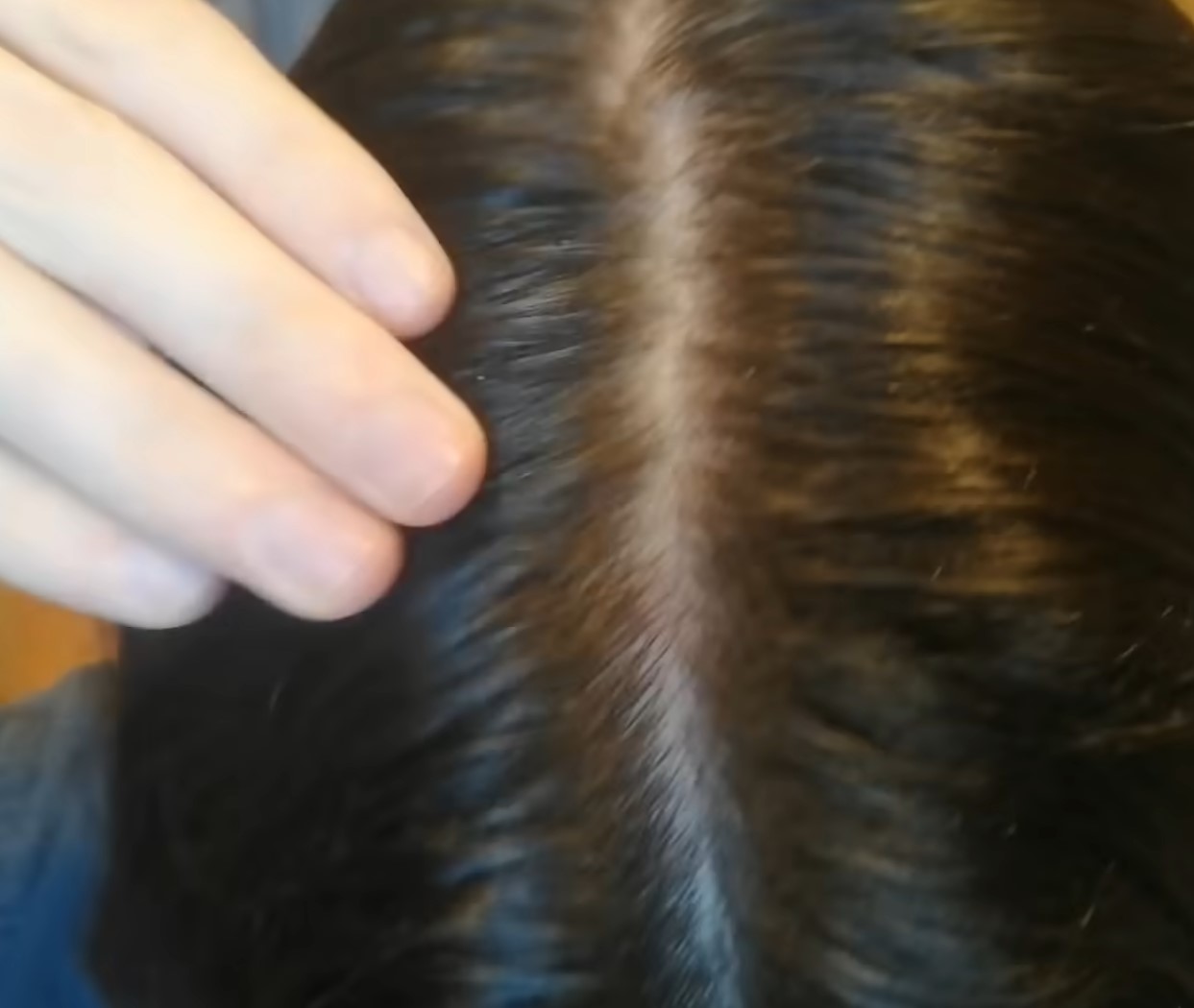 After 7 years of shampoo-free, Aidan's hair and scalp were in great condition, maintained by weekly cold water washing. Image Credit: YouTube/Garden of Aidan