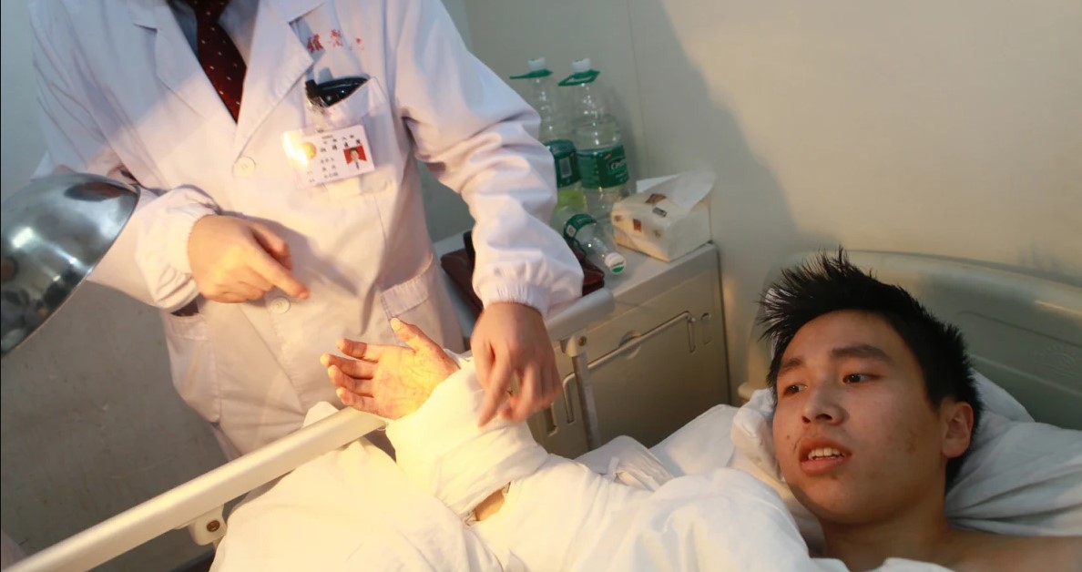 Doctors in China saved a man's hand by temporarily grafting it onto his ankle in a medical breakthrough. Image Credit: STR/AFP via Getty Images