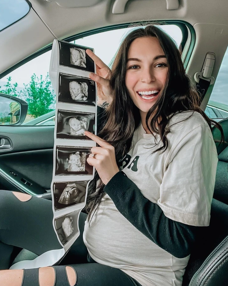 A pregnant woman who had rescued a stray cat discovered they were both expecting babies 1