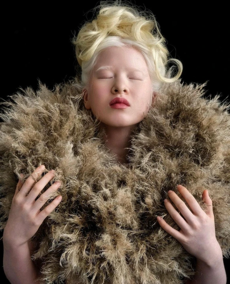Xueli Abbing: Abandoned baby because of albinism becomes a Vogue model 1