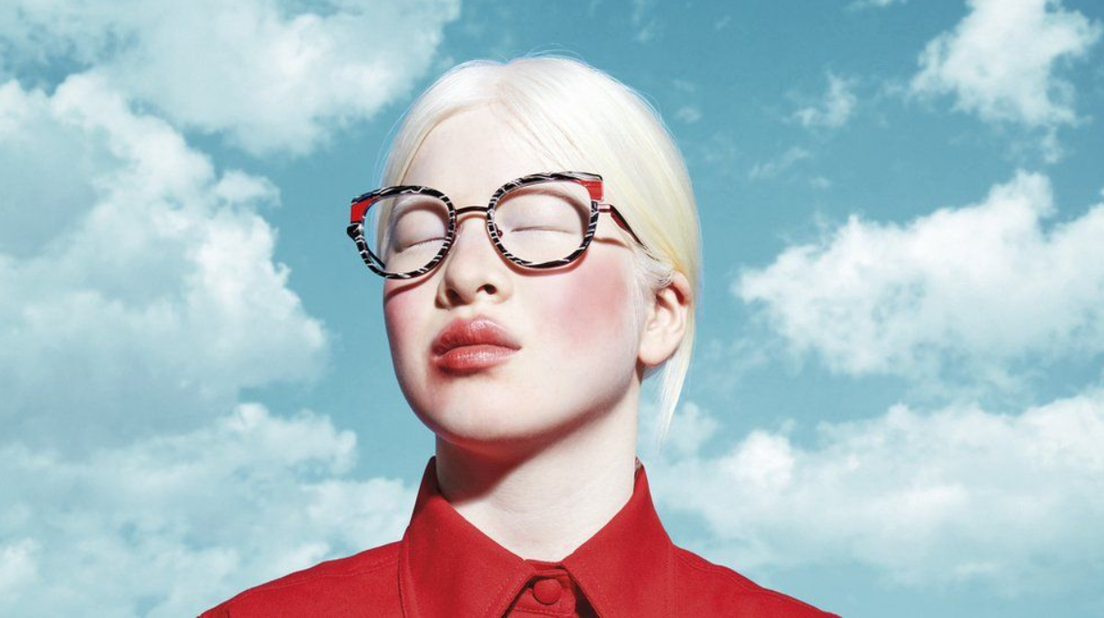 Xueli Abbing: Abandoned baby because of albinism becomes a Vogue model 3