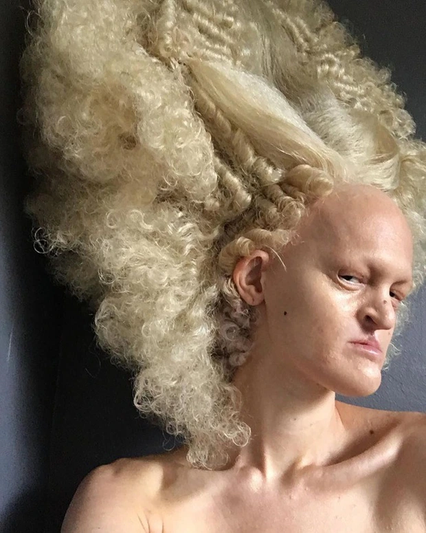 Meet Melanie Gaydos, who has had a rare condition since infancy and breaks all stereotypes about fashion 7