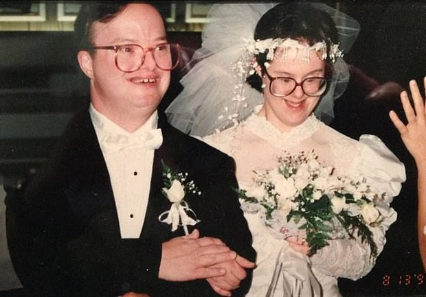 The couple with Down syndrome had been together for 25 years, only separating when their husband died 2
