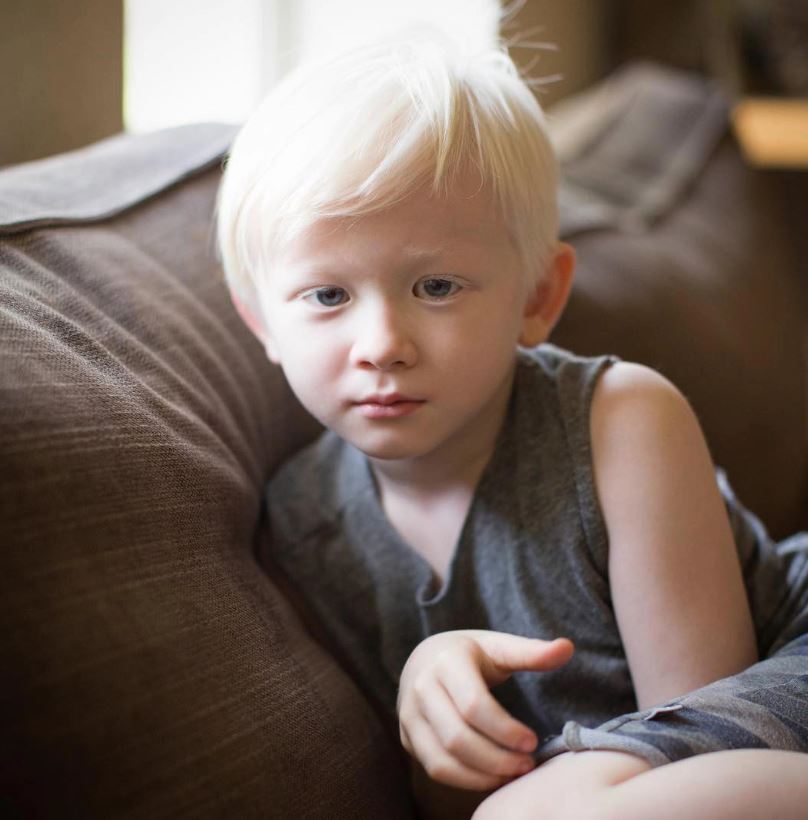 Giving birth to a child with white snow hair, the mother is unaware of the child's dangerous illness 7