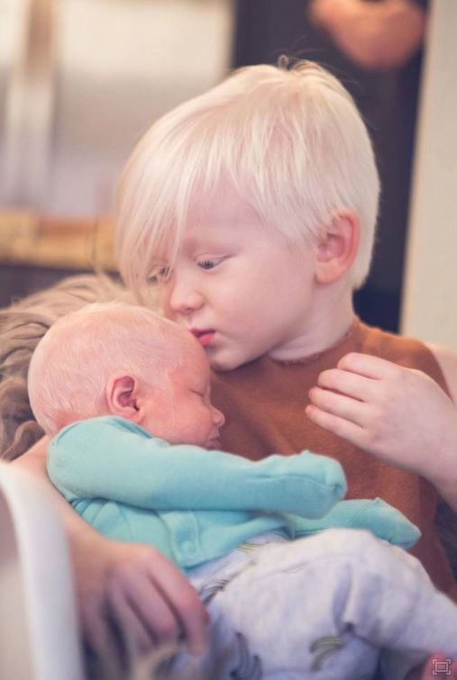 Giving birth to a child with white snow hair, the mother is unaware of the child's dangerous illness 9