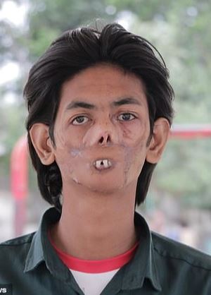 The 18-year-old boy is shunned by the villagers and called 'the ghost boy' because of his disfigured appearance 2