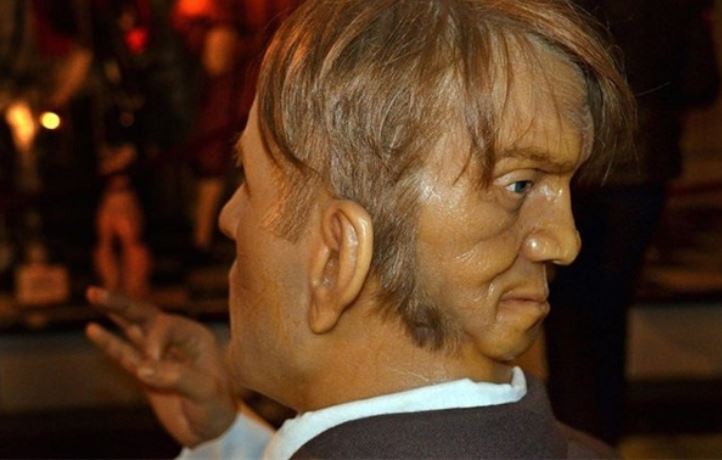 The ghostly face on the back of the man's neck puzzled medicine. The image of Mordake has been made into a wax figure